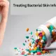 Why Antibiotics Are Essential in Treating Bacterial Skin Infections