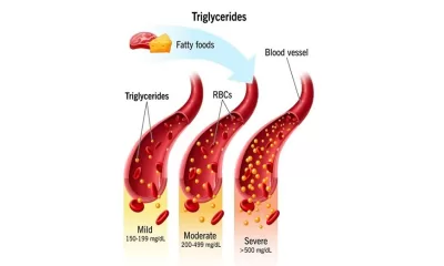 Cholesterol and Triglycerides