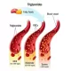 Cholesterol and Triglycerides