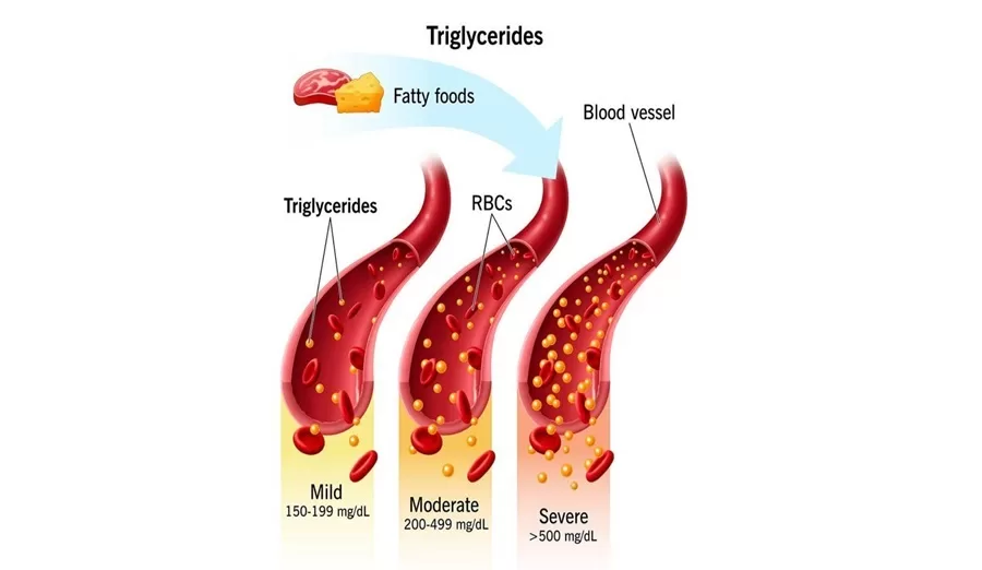 Cholesterol and Triglycerides